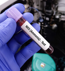 Poster - Blood sample for Ammonia test to diagnosis of ammonia levels also known as hyperammonemia. urea cycle deficiencies.