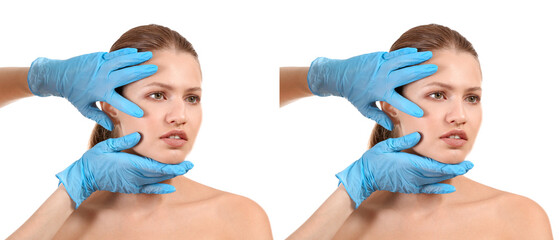 Poster - Surgeon examining face of young woman before and after rhinoplasty on white background