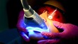 Close-up of a patient undergoing advanced dental procedure using uv light technology