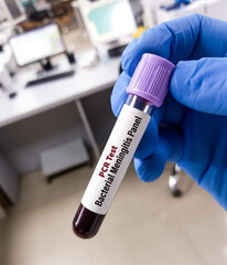 Poster - Blood sample for Meningitis Bacterial panel test by PCR. Diagnosis of brain infection medical concept, meningitis, encephalitis.