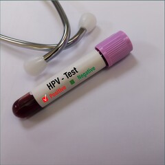 Sticker - Blood sample for HPV VIRUS (Human Papillomavirus) test.