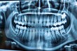High-definition panoramic dental x-ray showing adult teeth