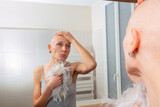 Fototapeta  - Woman, patient of cancer treatment facing hair loss reality