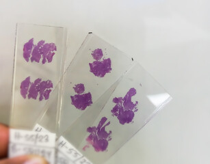 Canvas Print - Close view of Histopathology slides stained with hematoxylin and eosin or HE stain, ready for microscopic examination with Laboratory background, Histology.