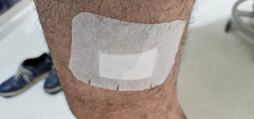 please ensure that a sterile patch is applied to the incision on the patient's leg, which was caused