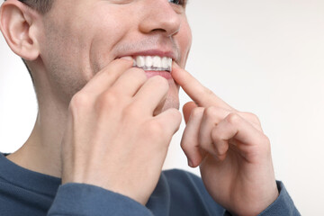 Canvas Print - Young man applying whitening strip on his teeth against light background, closeup