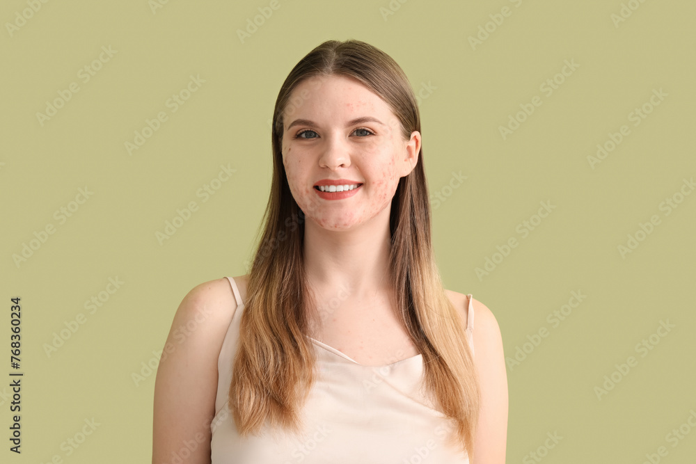Young woman with acne problem on green background, closeup