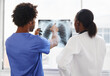 © peopleimages.com - Doctor, nurse and review xray for healthcare, collaboration for surgery and treatment plan with cardiology. Black people study lung scan, MRI or radiology, medicine and surgeon with team at hospital