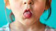Close-up of the child's tongue, ulcers and wounds on the tongue, oral cavity disease. 