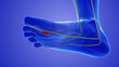 Neuroma painful foot condition or pinched nerve