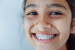 smiling teenage indian girl with braces, close up portrait of indian teen, orthodontic treatment, blurred background