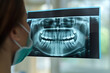 Examined X-ray of patient teeth by an orthodontist stomatologist AI Generative