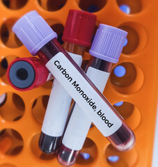 Canvas Print - Blood sample for Carbon monoxide test which is used to diagnose carbon monoxide poisoning.