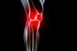 © Teppi - X-ray image of a sore knee, pain marked in red, medicine, advertising, black background