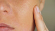 © julia_diak - skin with enlarged pores and foundation. Problem clogged skin