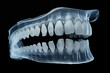 In dental office with a 3D scan model of patient jaw teeth based on panoramic x-rays AI Generative