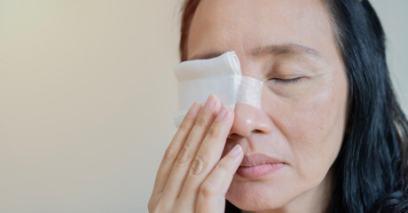 close-up of an adult asain woman having a gauze bandage on his right eye over light beige background