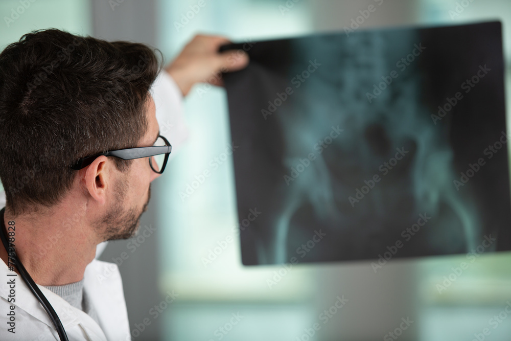 doctor examining a lung radiography Stock Photo | Adobe Stock