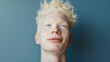 studio portrait of albino man with blue eyes