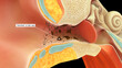 cerumen or earwax in human ear 3d illustration