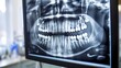 De-focused image of a panoramic dental x-ray on a mo  AI generated illustration