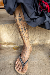 Wall Mural - Hindu devoteeâ€™s tattooed leg in Dediapada, Gujarat, India