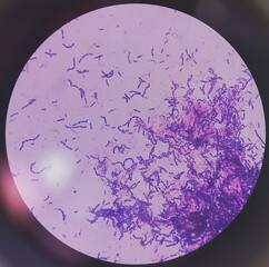 Poster - Yeast Infection; Budding yeast and pseudohyphae of Candida albicans, gram's stain. This fungus commonly affects vagina and vulva, oral (thrush) and diaper rash.