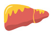 fatty liver disease. vector illustration