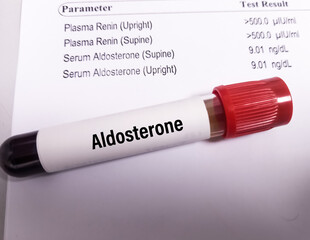 Wall Mural - Blood sample for Aldosterone hormone test with report.