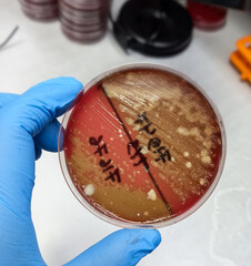 Wall Mural - Streptococcus bacterial colonies with beta hemolytic on blood agar plate, medical background. Microbiological examination. Culture and sensitivity testing.