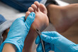 Close up removing a callus on a womans foot by nippers. 