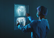 Doctor looking at total hip replacement X-ray film with blurred hospital background.
