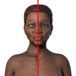 An African woman with Graves' disease and her healthy counterpart, 3D illustration