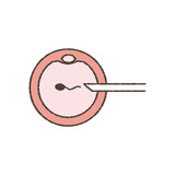 Fototapeta  - Illustration of microinsemination.