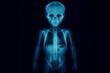 X-ray of a child full body blue tone radiograph on a black background