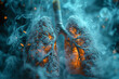 smoker's lung
