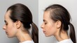 Compares of woman hair from bald to hair after using treatment or a hair transplant.