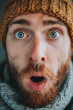 Close-up of surprised red-haired man, surprised expression.