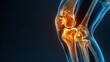 Right-side x-ray shows knee joint replacement surgery and blank area after the surgery