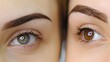Female eyebrows both with and without brow adjustment. Close-up
