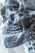 X-ray close-up featuring the idea of the brain and skull, from a medical series