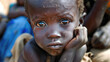 Somalia kid starving 