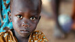 Somalia kid starving 