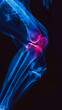 Blue x-ray photograph of knee pain, pain glows red. Trauma concept. Medical checkup. Generative AI