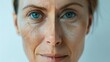© mariiaplo - Aging Process and Skin Care: Woman's Face Before and After Treatment
