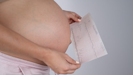 Wall Mural - Pregnant woman with bare belly holding Cardiotocography results. 