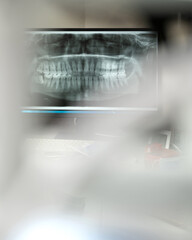 Panoramic shot of patient's jaws on computer display in clinic. X-ray of patient's jaws on monitor. Diagnosis of dental diseases. Dental treatment. Soft focus. Front view. High quality photo