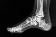 This x-ray captures a clear view of the bones within a foot, providing a detailed visualization of its structure, Ankle joint as seen in an X-ray, AI Generated