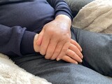 Fototapeta  - mains de personne âgée avec de l'œdème dans son fauteuil
