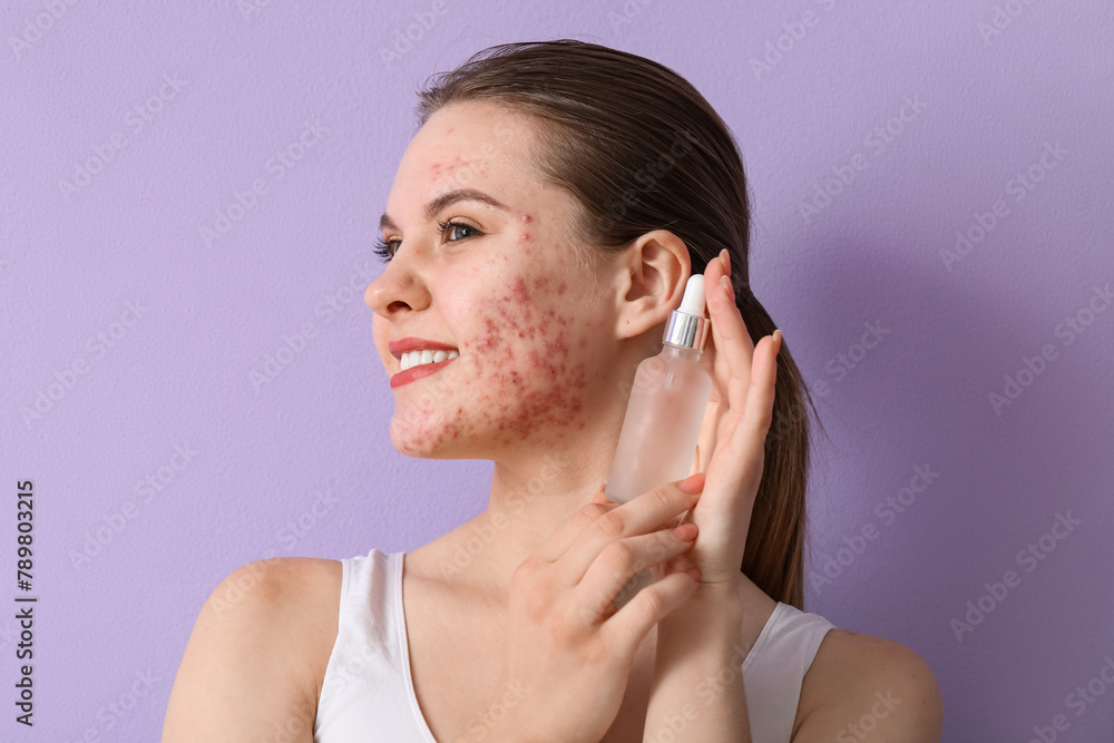Young woman with acne problem and serum on lilac background, closeup